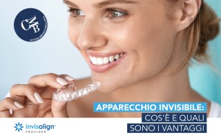 Apparecchio invisibile: cos’è e quali sono i vantaggi