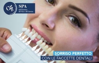 Sorriso perfetto con le faccette dentali