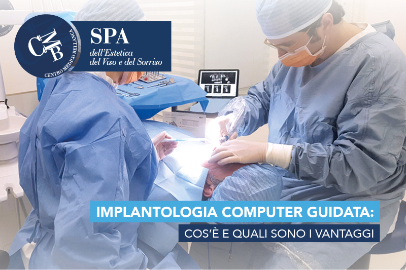 Implantologia computer guidata: cos’è e quali sono i vantaggi